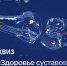 ИТОГИ Квиза “Здоровье суставов в надежных руках” - Центр НПМР ЛО