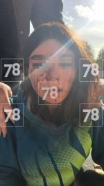 Перелом носа, швы и ссадины головы: девятиклассницу избили в Ленобласти